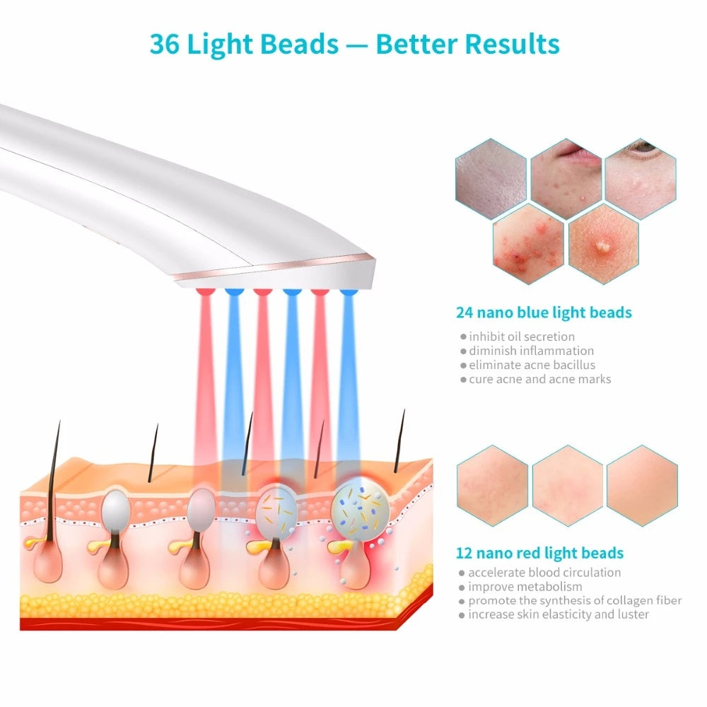 Xpreen Wireless Acne Clearing Eraser: Rechargeable Light Therapy Device with Blue and Red Light Treatment